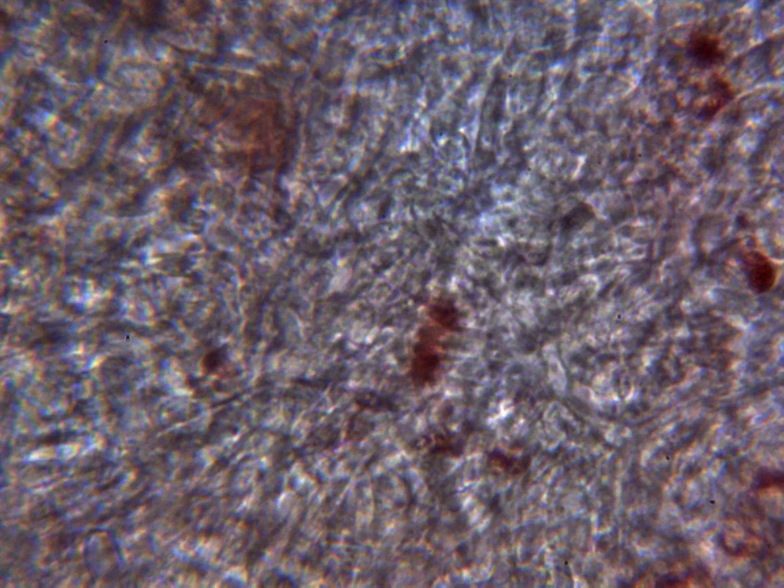 10 - Excípulo medular